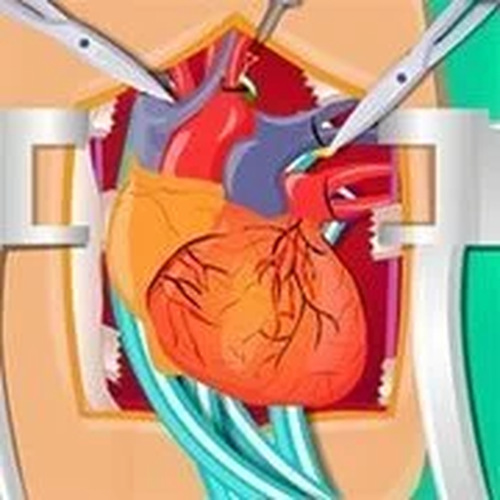 Heart Surgery Simulation Online Game